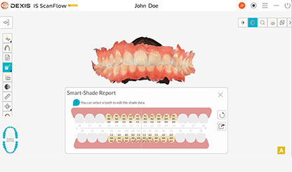 長崎市坂本・工藤デンタルクリニック・歯科用CT