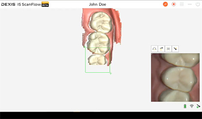 長崎市坂本・工藤デンタルクリニック・歯科用CT